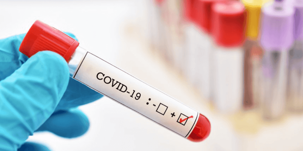 covid test CNJ